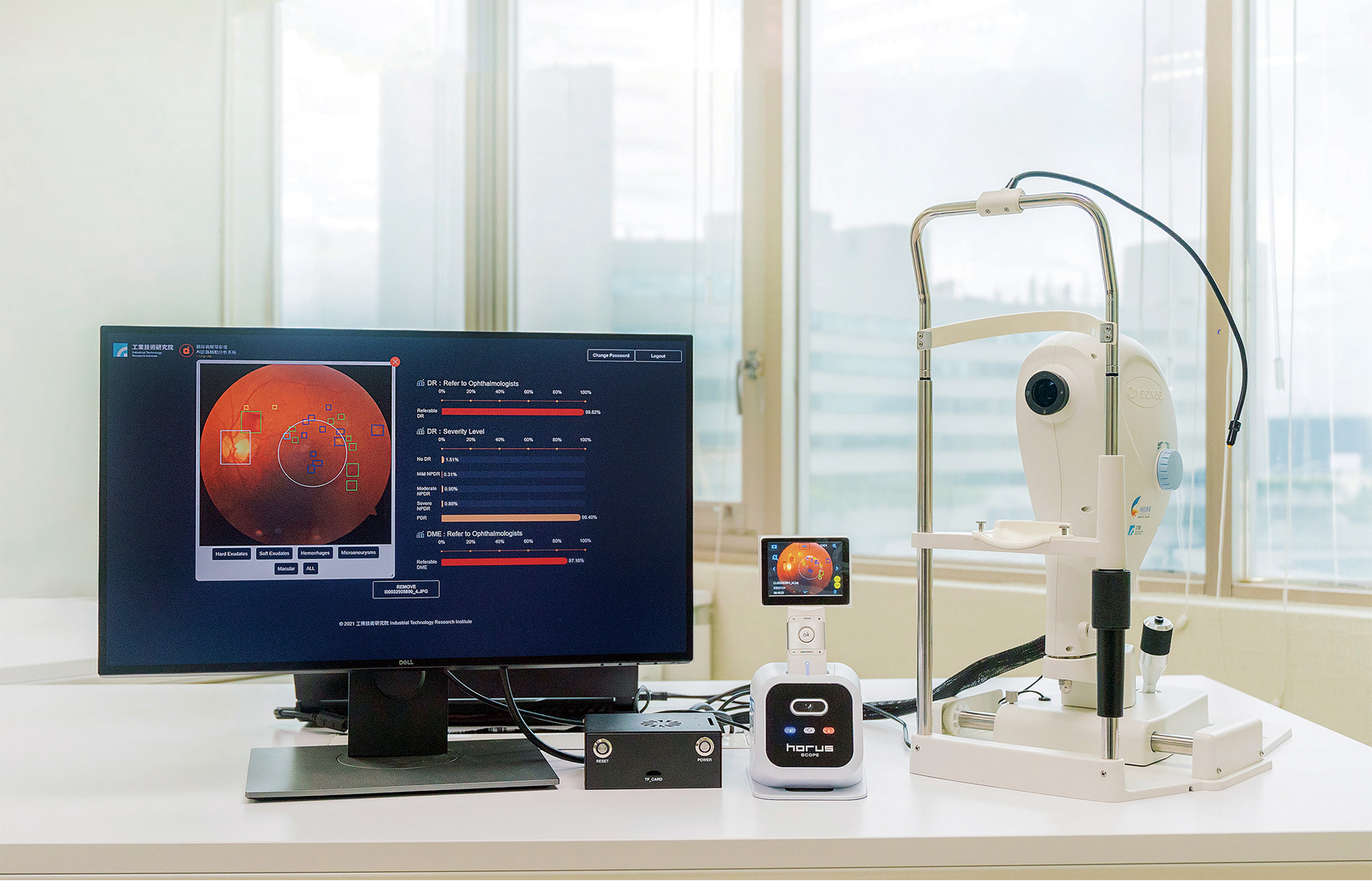 Point-of-Care AI-DR is the first AI-based solution that can locate four main lesions, classify five severity levels of DR, and determine whether a patient should be referred to an ophthalmologist.